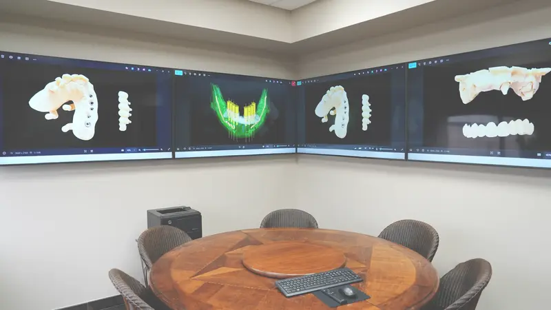 Digital treatment planning room with wraparound displays